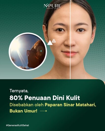 NPURE CICA BEAT THE SUN (1)